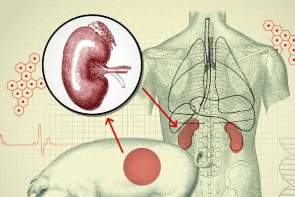 pig lung transplant