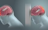 brain injury illustration