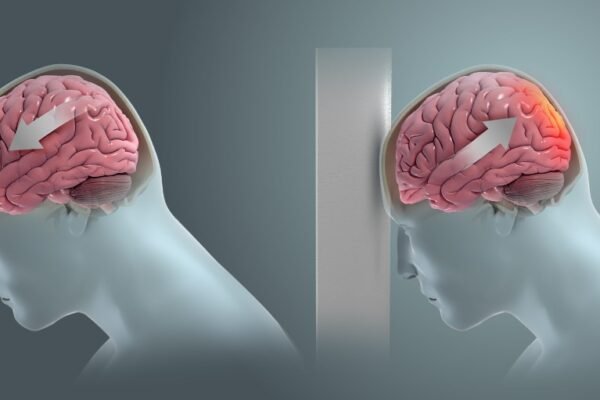 brain injury illustration