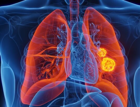 lung cancer research