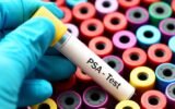 prostate cancer screening