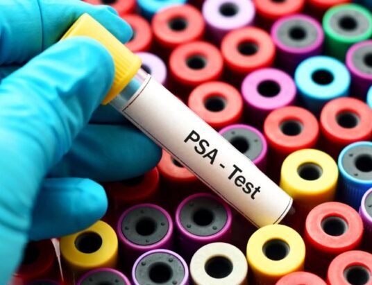 prostate cancer screening