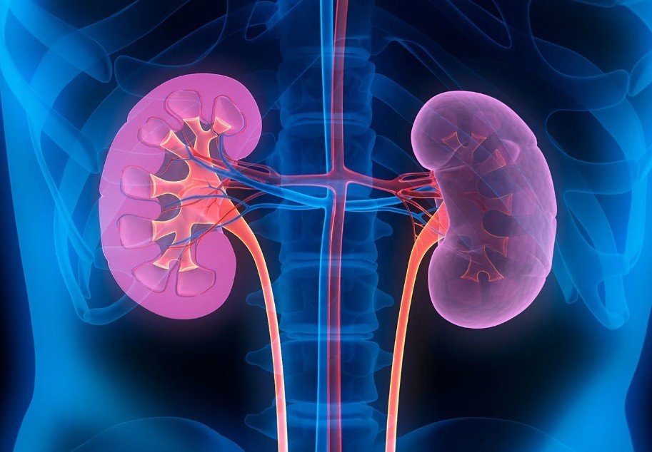down syndrome kidney study