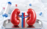 ABO incompatible kidney transplant desensitization process India